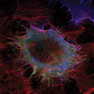 Jellyfish cell