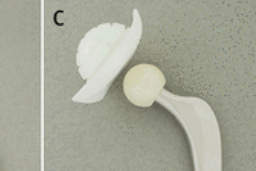 (C) ceramic-on-polyethylene, small head, cemented implant (head assembled with stem) 