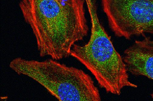 Image of a podocyte
