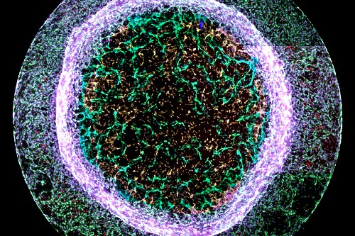 Recreating blood vessels by Elisa Avolio