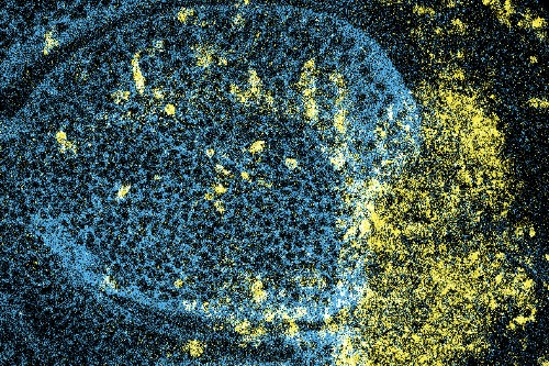 Mutant wing disc suffering from proteotoxic stress. Cells in the Posterior compartment (on the right, Cyan-negative) have been manipulated to downregulate Gr64 expression and show widespread cell death (Yellow), relative to control Anterior (Cyan-positive) cells.