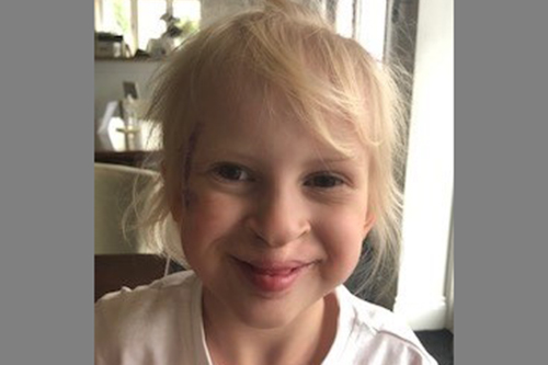 Elsie after her third surgery before her fifth birthday