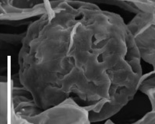 Caption: Electron micrograph of a grown, hydrogel-embedded tumour spheroid.

