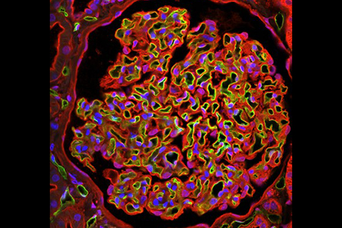 A healthy patient with the glycocalyx labelled bright green