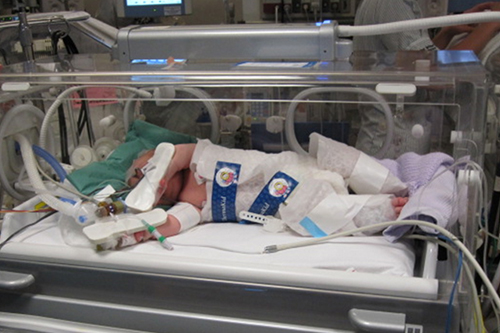 Newborn baby being cooled (circulating cold water in cooling jacket) during transport to Bristol after lack of oxygen at birth 