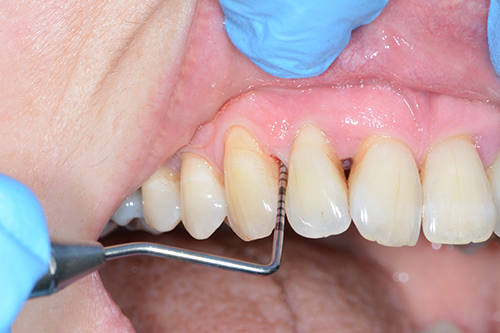 A person having a dental examination