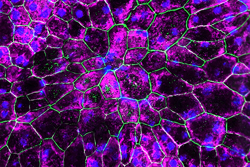 Rescued retinal pigment epithelium (RPE) cells following IRAK-M gene therapy