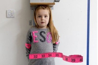 Waist-to-height ratio detects fat obesity in children and adolescents significantly better than BMI, study finds –  – University of Bristol – All news