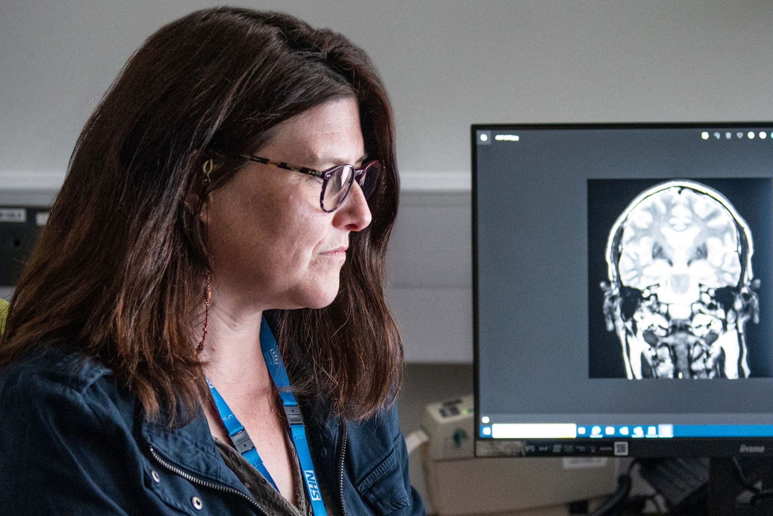 Elizabeth Coulthard, Professor of Cognitive Neurology at the University of Bristol