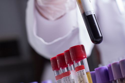 Picture of a test tube containing blood