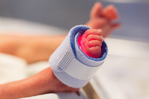 A premature baby's foot