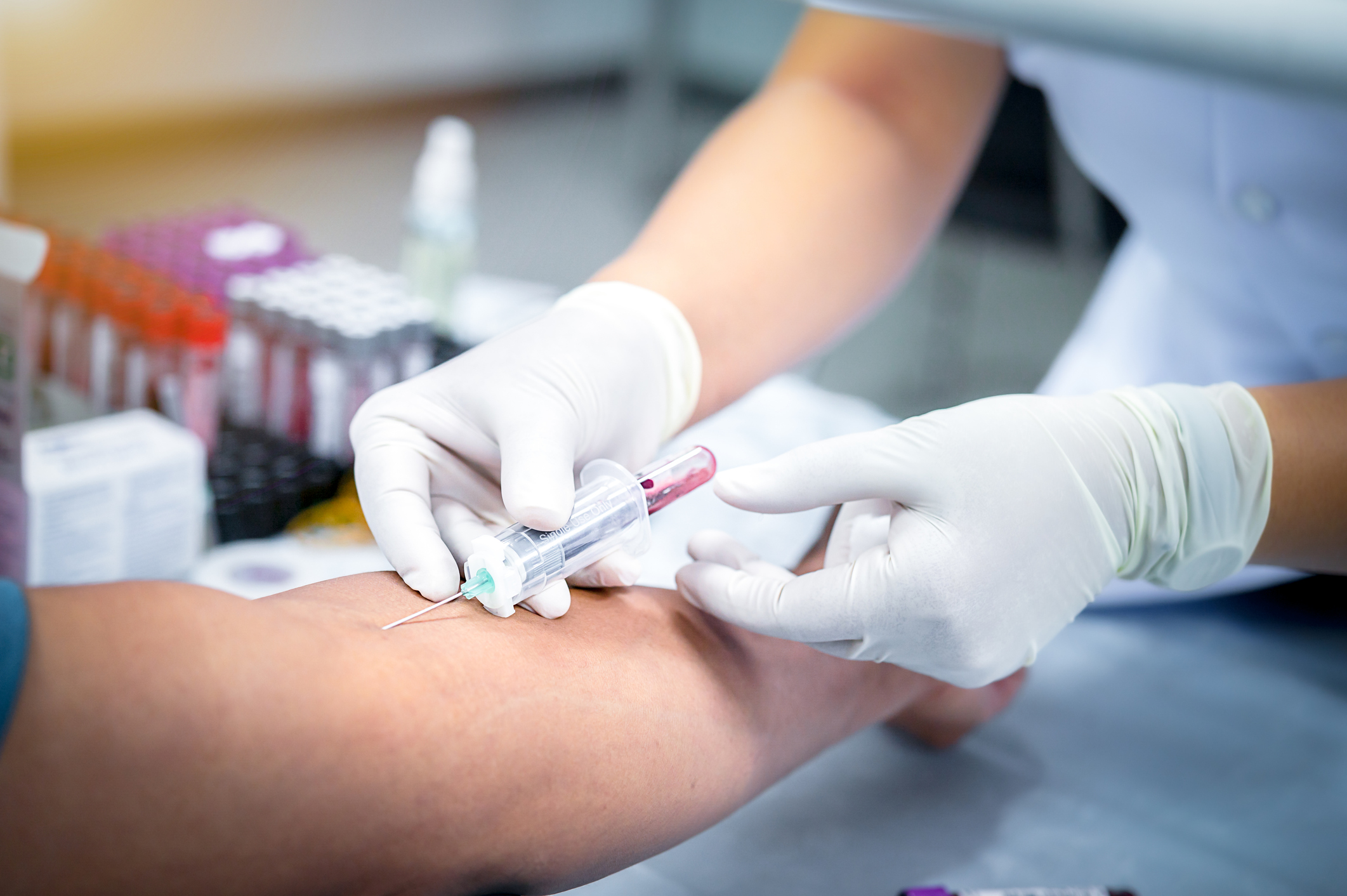 Blood being taken from a patient's arm.
