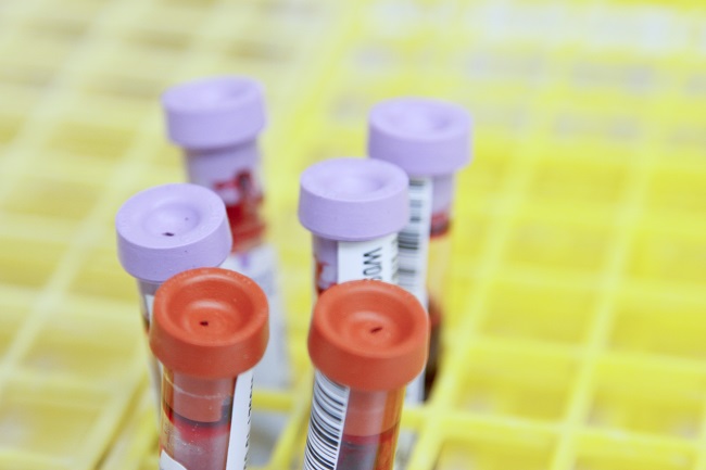 A part-filled tray of blood test tubes.