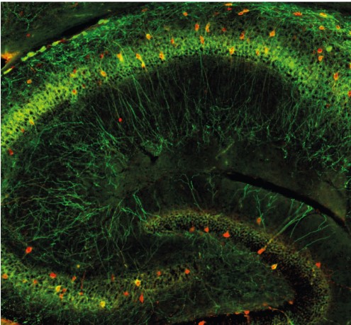Hippocampus_JM