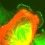 A small image of a podocyte cell line