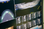 X-ray results showing teeth