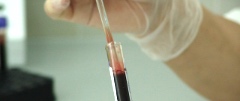 Test tube containing blood sample