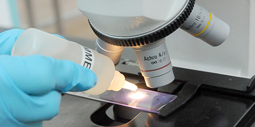 Person adding immersion oil to a microscope slide, directly over the spot of light from microscope.