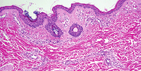 pathology histology