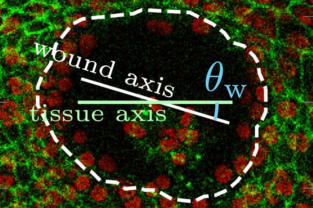 Fluorescent microscope image of a wound closing with labels showing directions