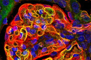 Fluorescent microscope image of healthy micro vessels in kidney tissue