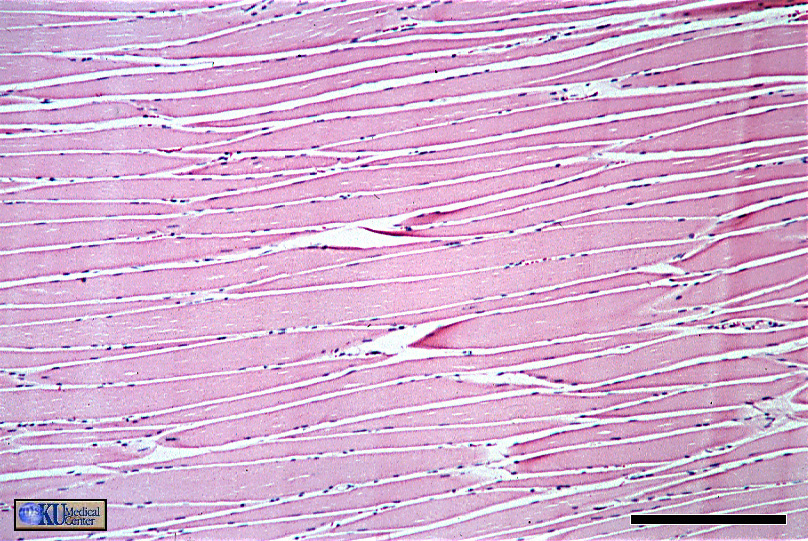 Skeletal muscle Longitudinal section.  Bar is 250 microns