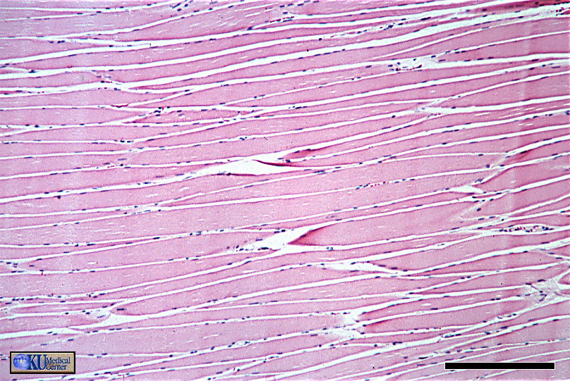 skeletal muscle cross section labeled