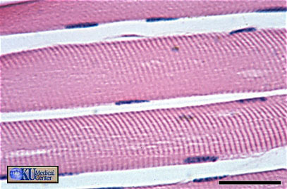 Skeletal muscle longitudinal section at high magnification.  Bar is 30 microns