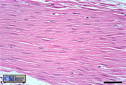 Smooth muscle in longitudinal section.  Bar is 50 microns