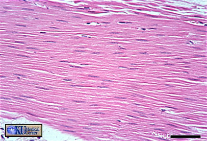 skeletal muscle cross section labeled