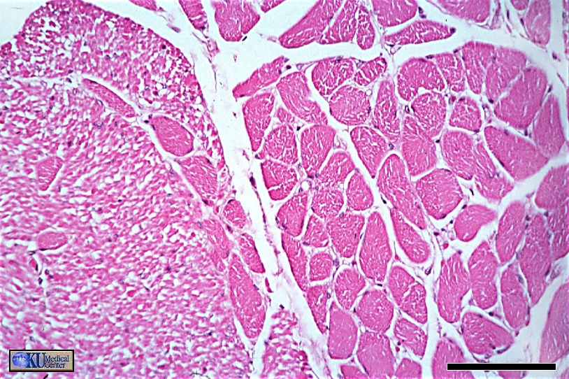 Skeletal & smooth muscle in transverse section.   Bar  is 100 microns