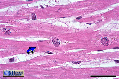 cardiac muscle tissue labeled diagram