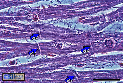 Cardiac Muscle in longitudinal section (phase-contrast optics). Bar is 30 microns