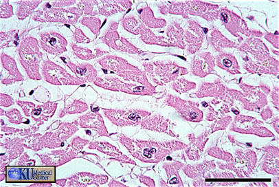 Cardiac muscle in transverse section. Bar is 50 microns