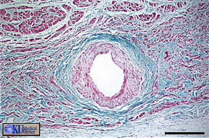 Sino-atrial Node.   Cell sectioned approximately transversely.   Bar  is 250 microns
