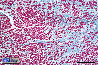 Nodal cells.   Bar is 250 microns