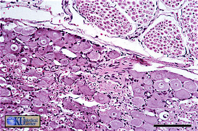 Dorsal Root Ganglion (DRG). Bar is 100 microns