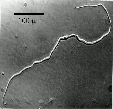 Micrograph of a human colonic smooth muscle cell.  The cell was isolated from the circular muscle layer of the colon by proteolytic enzymes.  